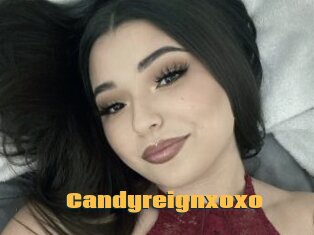 Candyreignxoxo
